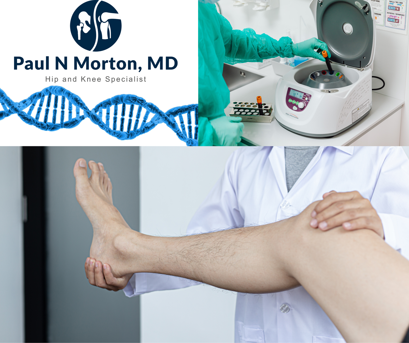 Collage for orthobiologics and regenerative medicine showing a DNA strand, a PRP centrifuge, and a knee examination.