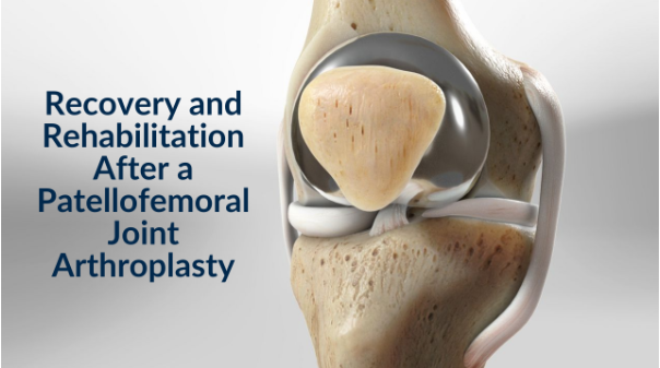 Graphic titled Recovery and Rehabilitation After a Patellofemoral Joint Arthroplasty beside a 3D knee anatomy model.