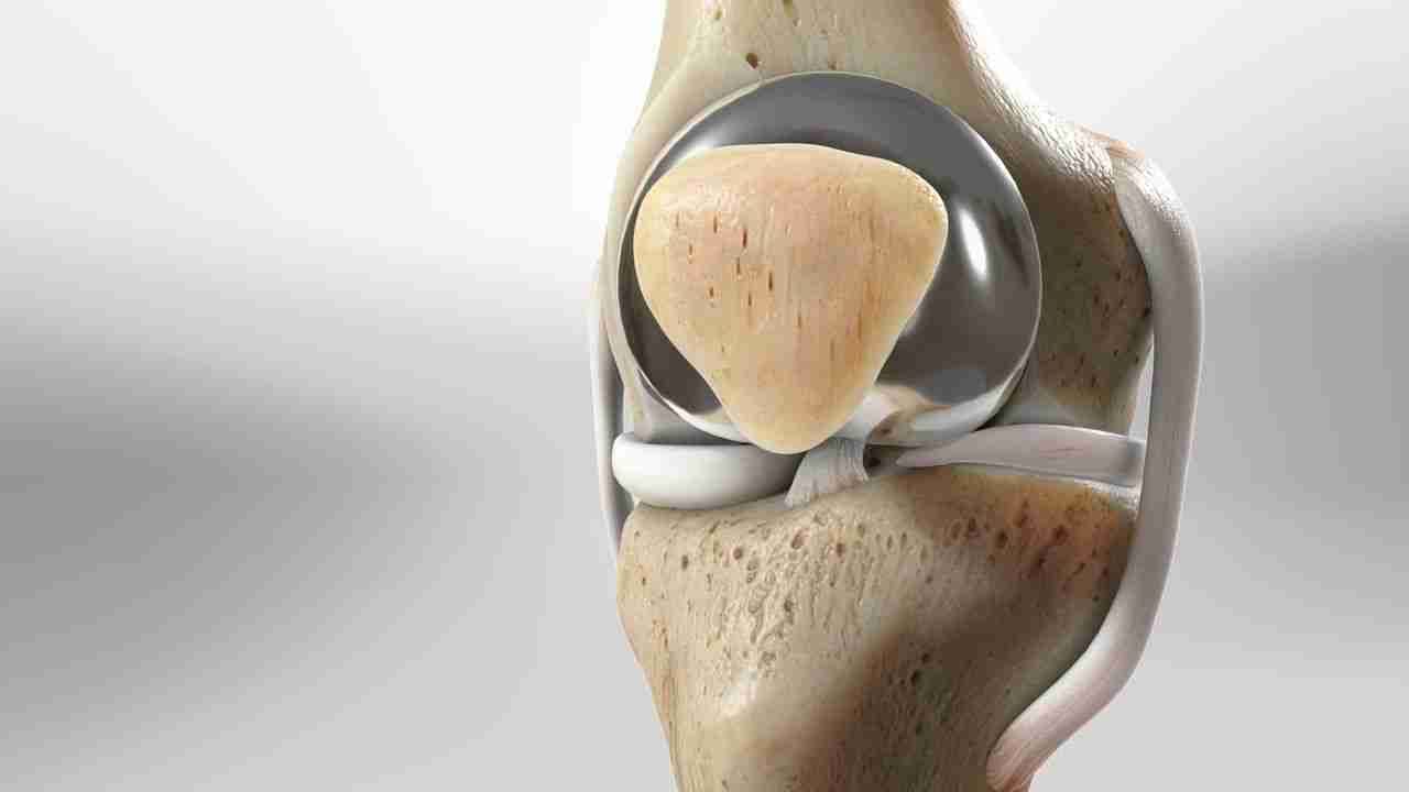 3D medical illustration of the patellofemoral joint showing the kneecap gliding over the end of the femur.