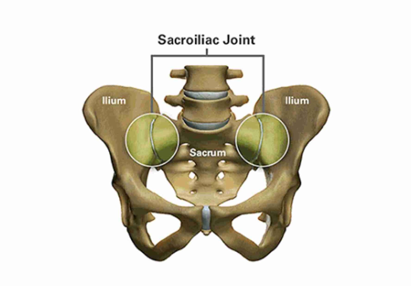 Labeled illustration of the sacroiliac joints where the ilium meets the sacrum.