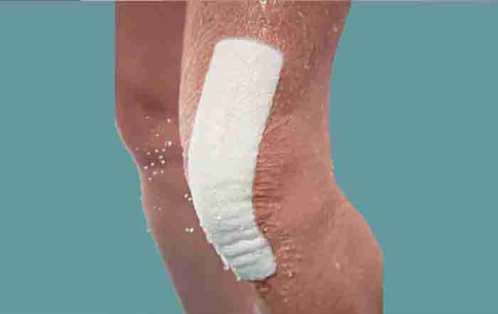 Waterproof absorbent surgical dressing covering a knee incision after surgery.