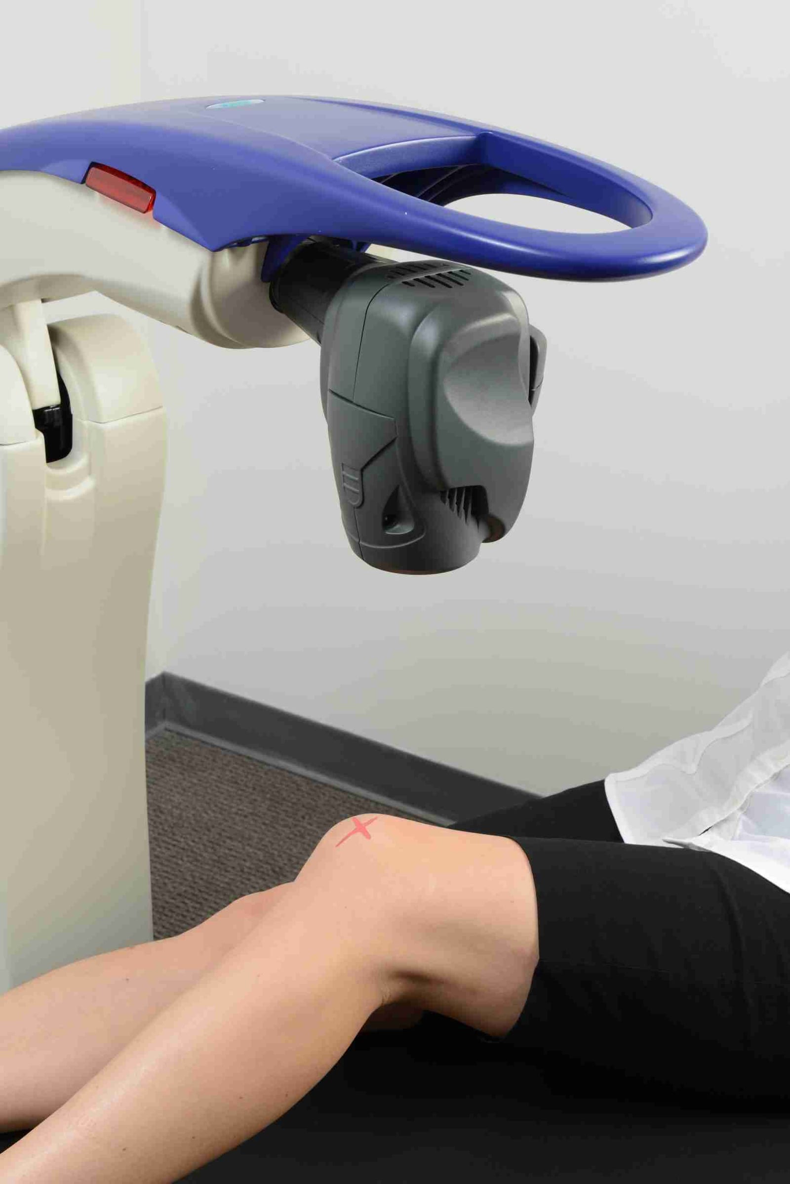 The MLS M6 robotic laser head positioned over a patient's marked knee during treatment.