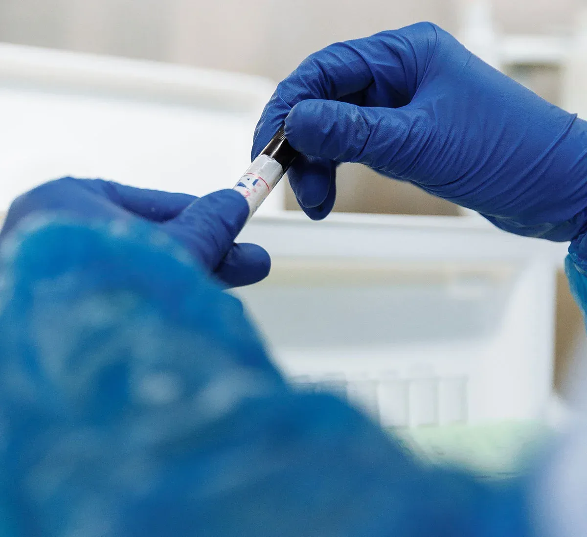 Gloved hands hold a tube of the patient's own blood being prepared for platelet-rich plasma therapy.