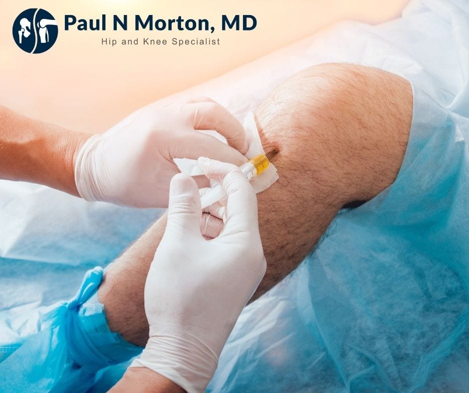 Clinician injecting platelet-rich plasma into the patellar tendon just below a patient's kneecap.
