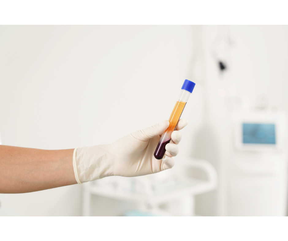 Gloved hand holding a test tube of golden platelet-rich plasma separated from red blood cells.