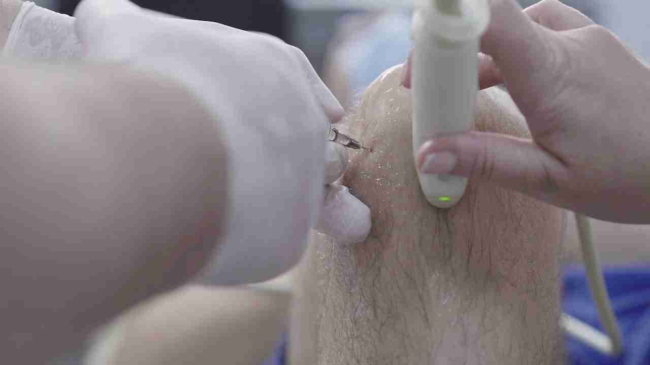 Close-up of a clinician performing an ultrasound-guided injection into a patient's knee.