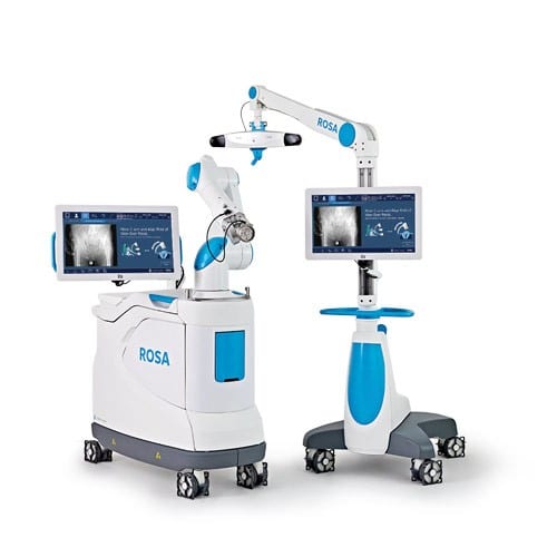 The ROSA robotic surgical system with its robotic arm and navigation screens, used for robotic hip replacement.