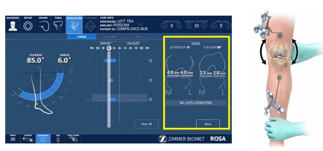 ROSA Knee evaluation screen recording soft-tissue balance while the surgeon flexes the patient's knee.